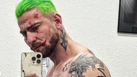 Er lacht jetzt für immer - Skandal-Rapper wird durch  Tattoos zum „Joker“