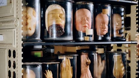 The Mütter Museum Reckons with Human Remains in Its Collection