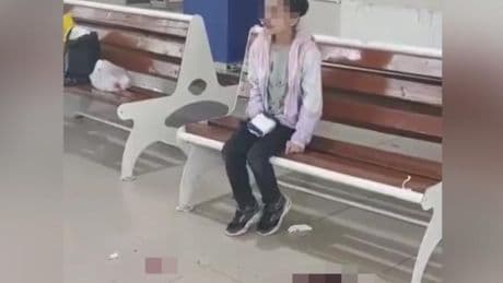 Yaralı çocuğa ambulans yok | Ambulanssız sevk edilirken kanama başladı