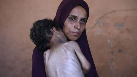 Gaza, l’orrore della "fame di massa"