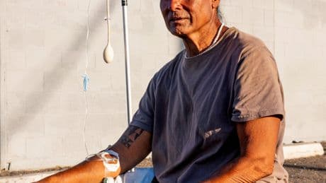 Asphalt Burns and Heatstroke: Homeless in America’s Hottest City