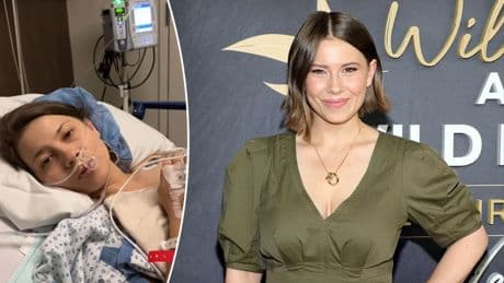 What is a chocolate cyst? Bindi Irwin's health condition and what to know about it