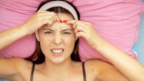« Je suis dermatologue, et voici les 7 pires habitudes qui aggravent l’acné »