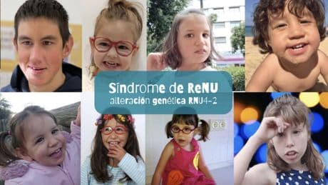 Génétique : comment le diagnostic des troubles du développement intellectuel progresse