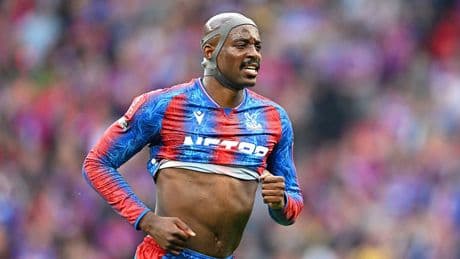 Why is Jean-Philippe Mateta wearing a protective helmet in the FA Cup final?