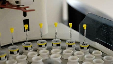 Diagnostic d’Alzheimer : un nouveau test en 5 minutes