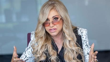 Räuber würgte sie mit beiden Händen - Carmen Geiss zeigt Horror-Foto ihrer Verletzung