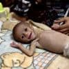 Zes maanden oud, ondervoed en geboren in een ruïne: baby Siwar is het gezicht van de honger in Gaza