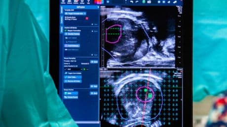Golpe español al cáncer de próstata: una combinación nueva de fármacos reduce en un 35% el riesgo de muerte