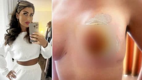 Mum stuck in Turkey ‘could lose entire breast’ after botched boob job