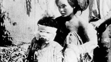 80 Jahre Hiroshima | Atombombeneinsatz: Die Illusion, dass Ärzte helfen