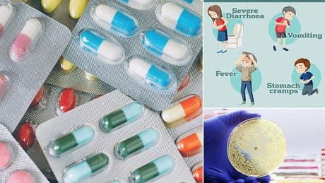 Common over-the-counter painkillers 'quietly fuelling' terrifying condition, study reveals - thousands of deaths every year