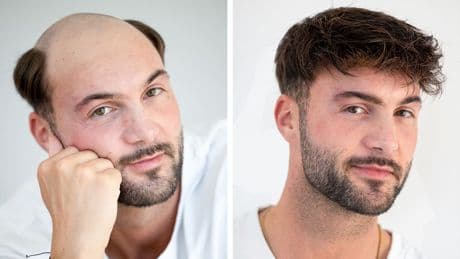 Chris (33) führt es vor - Die Wahrheit über meine Haarpracht