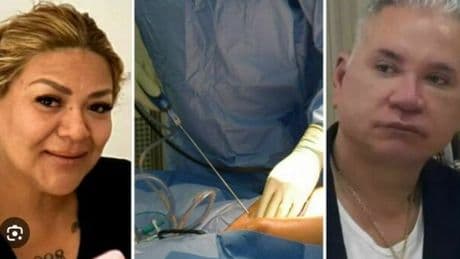 Roma, morta dopo la liposuzione: la segretaria indagata, operò lei Ana Sergia Alcivar Chenche. La donna si spacciava per medico. Chi è Olivia Buldrini
