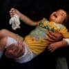 Government plans to bring more Gazan children to UK for treatment
