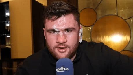 Johnny Fisher suffered horror BLOOD CLOT in his ear… but says he had worse injuries during his ‘posh’ rugby career