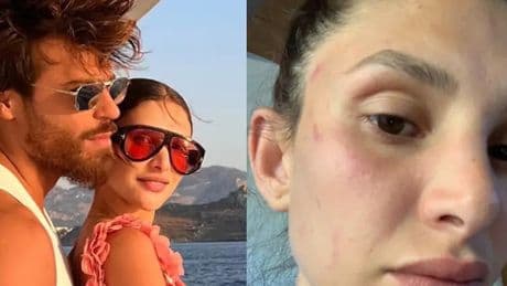 Sara Bluma denuncia le violenze dell'ex, il fidanzato Can Yaman: «Ti amo e ti sosterrò. Non lo ha tradito con me»