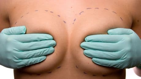 Studie zeigt - Brustimplantate: Bei 86 Prozent läuft Silikon aus
