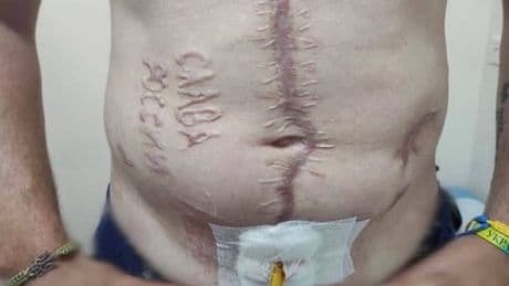 Russen brannten ihm Parole in Bauch - Die Geschichte zu diesem Horror-Foto