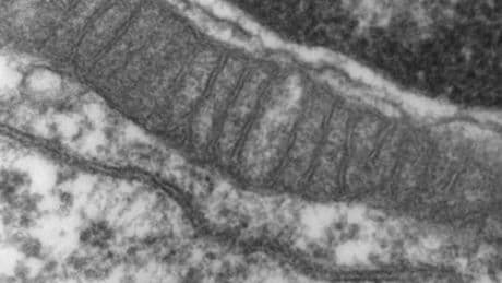 Maladie de Charcot: la potentielle origine de la maladie découverte par des chercheurs