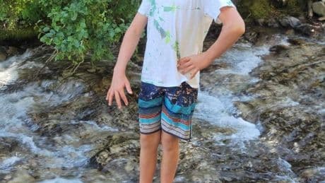 Dad shares heartbreaking photo of paralysed son, 16, as a warning to all parents after horror trampoline accident