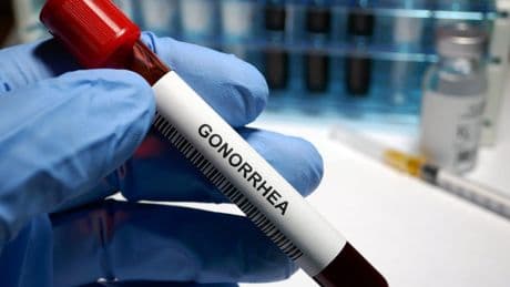 Expert warns of spread of super-gonorrhoea resistant to antibiotics