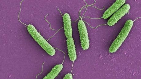 Gamechanger: Multiresistente Bakterien schnell erkennen und behandeln