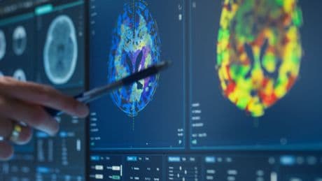 Alzheimer tedavisinde 'lityum' umudu