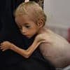 Famine 'will be officially declared in Gaza City TODAY' by body responsible for monitoring world hunger