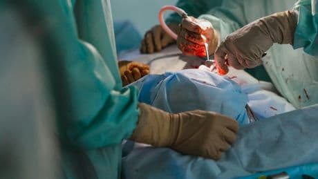 Realizan por primera vez un trasplante de pulmón de cerdo a un humano