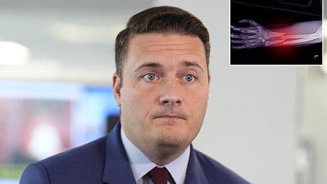 Charities urge heath secretary Wes Streeting to act now to stop deaths from fractures