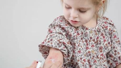 Buying one thing could stop children getting eczema really young say experts