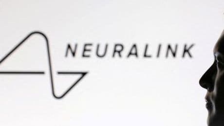 Neuralink: Elon Musks Gehirnchip-Firma sammelt 650 Millionen Dollar ein