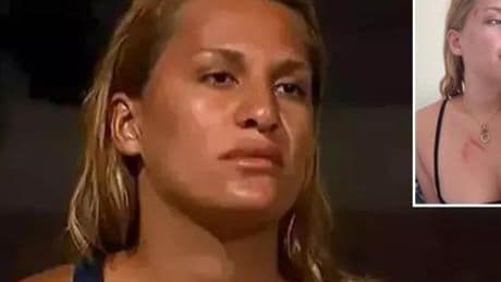 Survivor Almeda Baylan kaza geçirdi! O anları ve son durumunu anlattı: Ölümden döndük