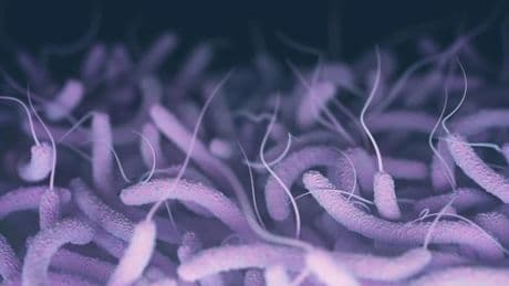 Halk Sağlığı Genel Müdürlüğü: Ülkemizde Vibrio kaynaklı herhangi bir vaka yok
