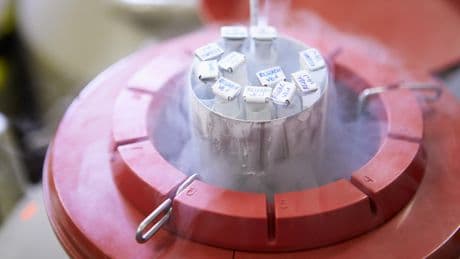 Comment un donneur de sperme a transmis un gène prédisposant au cancer à des dizaines d’enfants en Europe