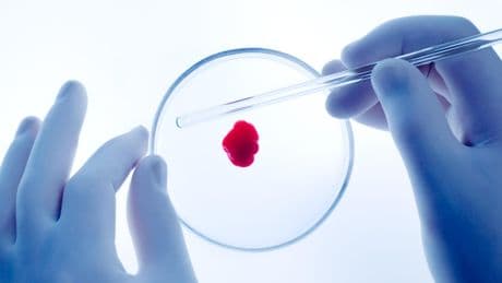 Sang artificiel : où en est vraiment la quête de l’or rouge ?