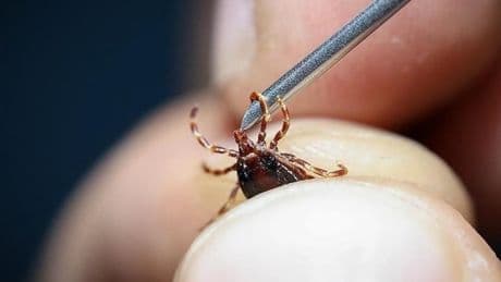 Bir ilde daha kene dehşeti yaşandı! Eliyle çıkarmaya çalıştı, hastalığa yakalandı