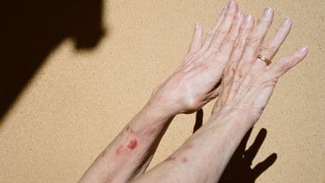 What My Two 98-Year-Old Patients Taught Me About Longevity