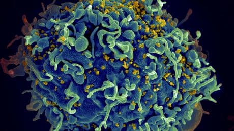 HIV tedavisinde çığır açacak adım: mRNA temelli yöntem umut verdi