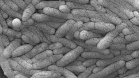 New salmonella outbreak is linked to backyard poultry, CDC says