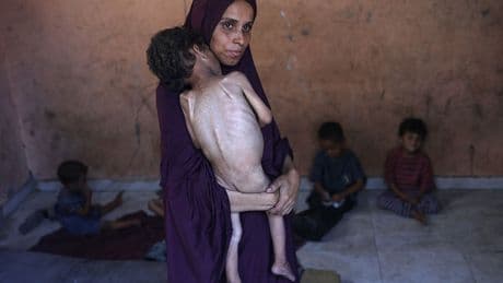 Children In Gaza Are Starving. Talking Is Not Enough.