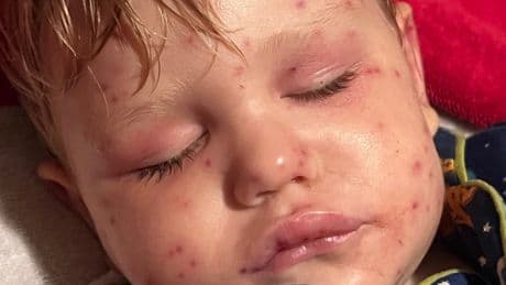 Toddler, 2, fighting for life after being stung 150 times by wasps while riding toy car