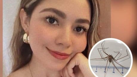 Muere una joven tras la picadura de una araña violinista: el veneno la mató en solo hora y media