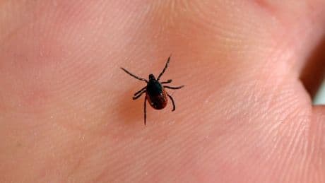 Lyme disease: What does a tick bite look like?