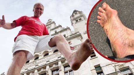Frank lief ohne Schuhe durch Deutschland - So sehen Füße nach 750 Kilometern Barfußlaufen aus