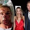 This is exactly how to deal with trauma in mid-life - and the lessons we should all learn from Freddie Flintoff and his brave wife Rachael: DR MAX PEMBERTON