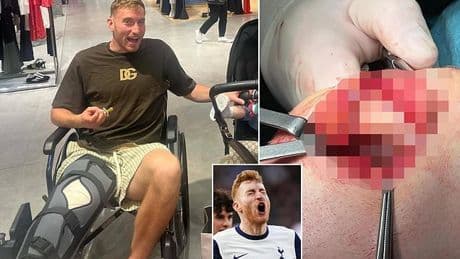 Tottenham star Dejan Kulusevski horrifies fans with gruesome picture from his knee surgery - and delivers update on when he'll be back playing