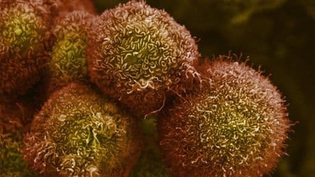 La “vacuna autoestopista” contra el cáncer logra resultados prometedores en 25 personas