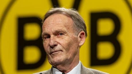 Watzke droht ein Machtkampf beim BVB